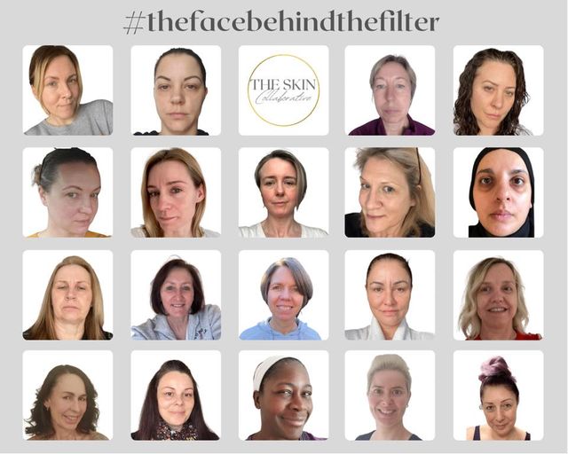 The Skin Collaborative behind the filter campaign